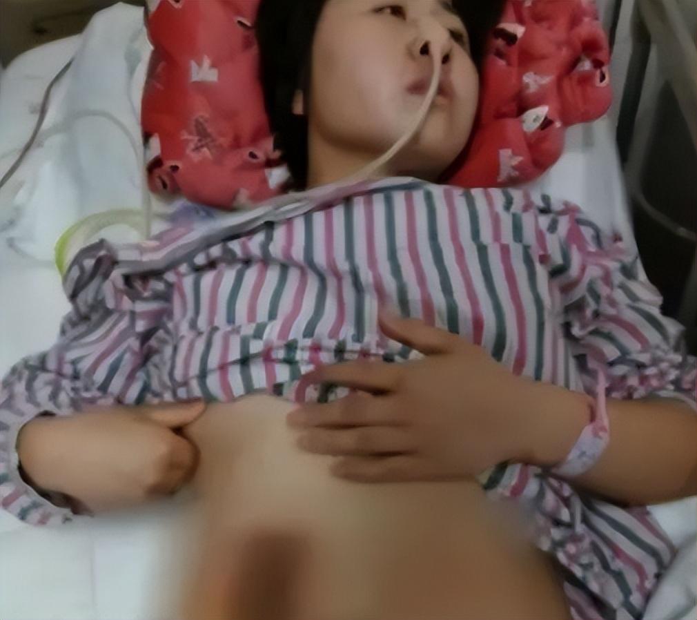 Trương Nhị Lợi bị tiêm dung dịch ăn mòn vào bụng, khiến phần lớn ruột bị hoại tử. Ảnh: Toutiao