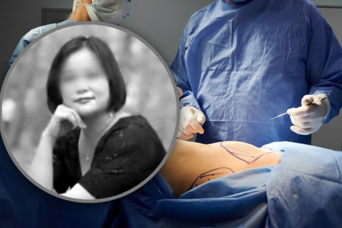 Người phụ nữ họ Liễu tử vong sau khi liên tiếp thực hiện nhiều ca phẫu thuật thẩm mỹ. Ảnh: SCMP
